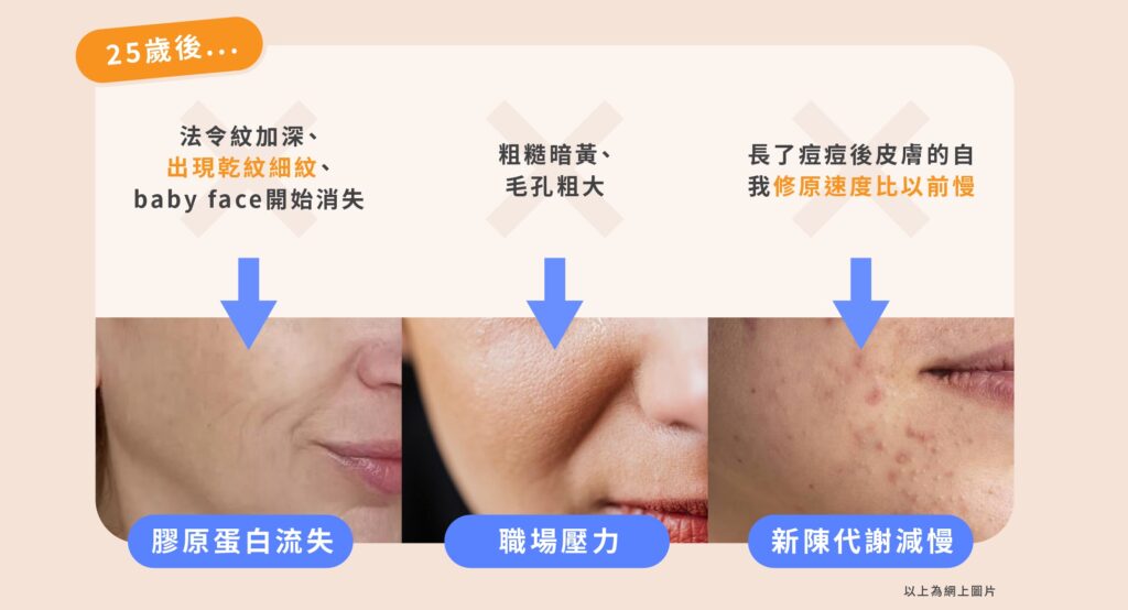 肌膚在25歲後開始老化
