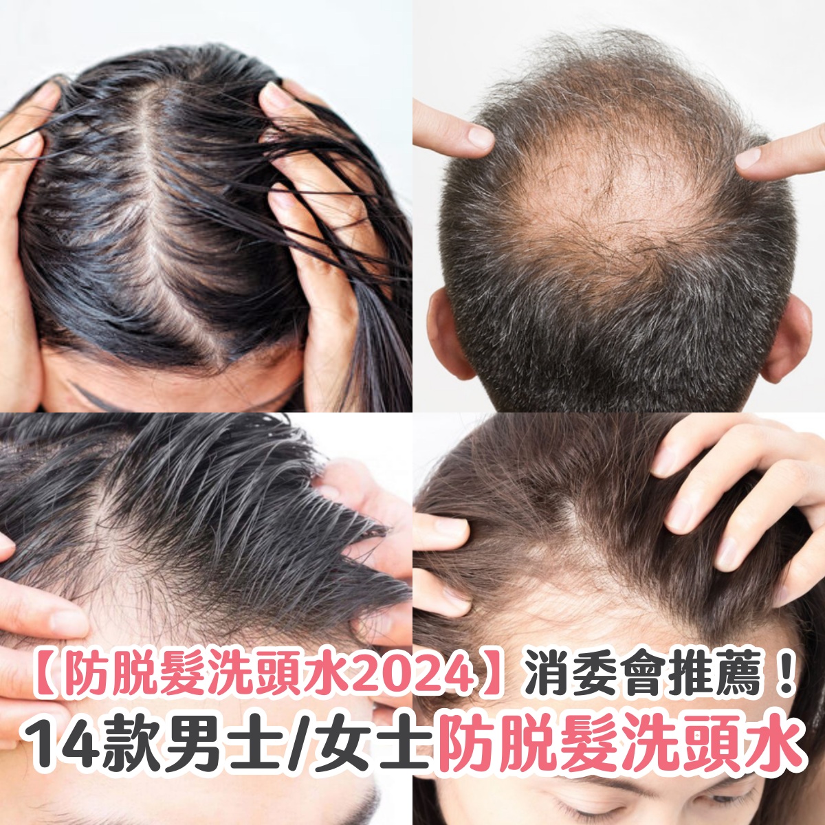 【防脫髮洗頭水2025】消委會推薦！14款男士/女士防脫髮洗頭水