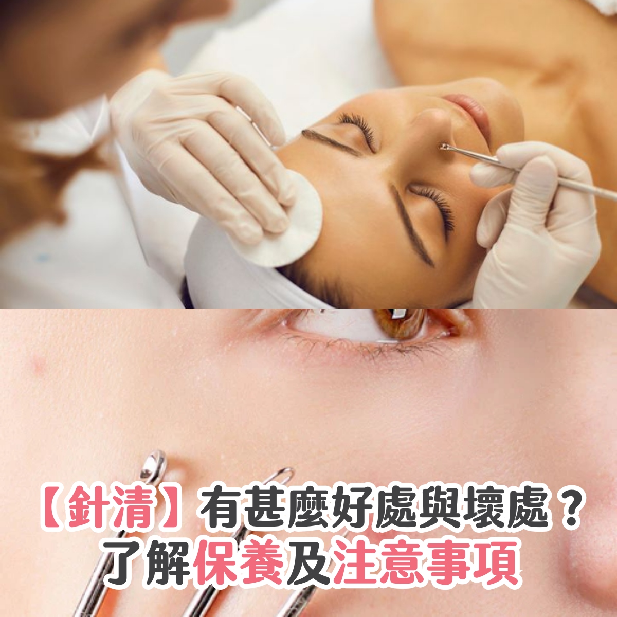 【針清】有甚麼好處與壞處？了解保養及注意事項