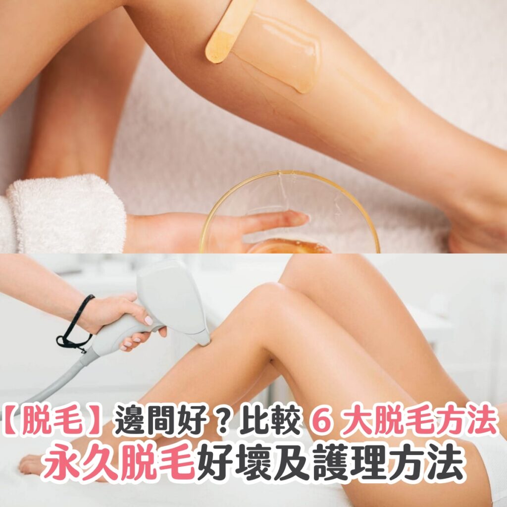 【脫毛】邊間好？比較 6 大脫毛方法、永久脫毛好壞及護理方法