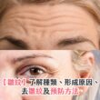 【皺紋】了解種類、形成原因、去皺紋及預防方法