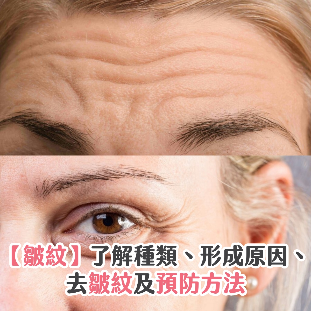 【皺紋】了解種類、形成原因、去皺紋及預防方法