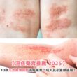 【濕疹藥膏推薦 2025】10款天然無類固醇濕疹藥膏！成人及小童都適用！