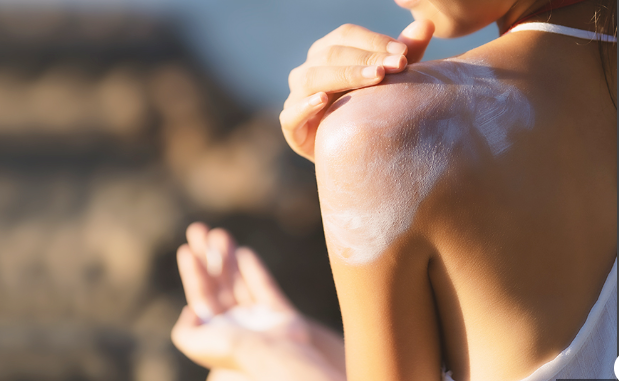 曬傷後的注意事項