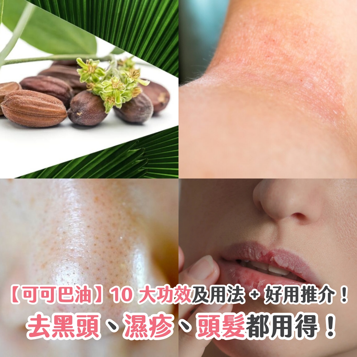 【可可巴油】10 大功效及用法 + 好用推介！去黑頭、濕疹、頭髮都用得！