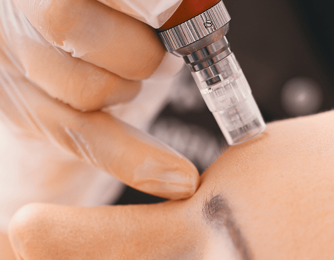 水光針是什麼？