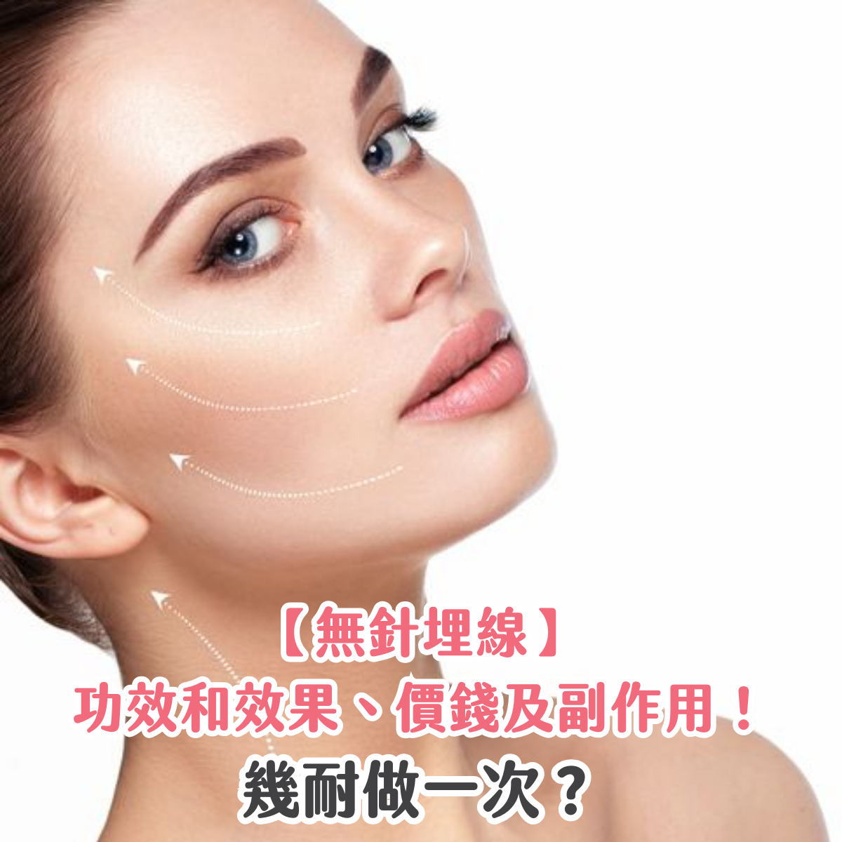 【無針埋線】功效和效果、價錢及副作用！幾耐做一次？
