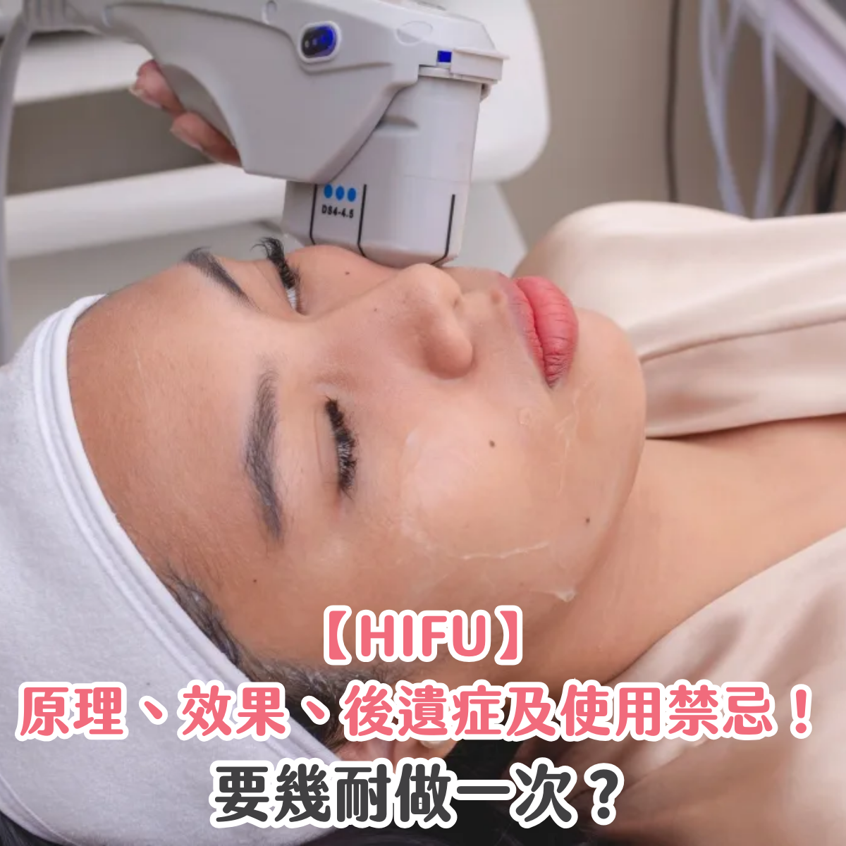 【HIFU】原理、效果、後遺症及使用禁忌！要幾耐做一次？