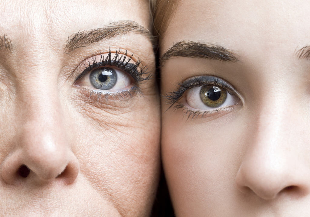 淡化細紋及皺紋