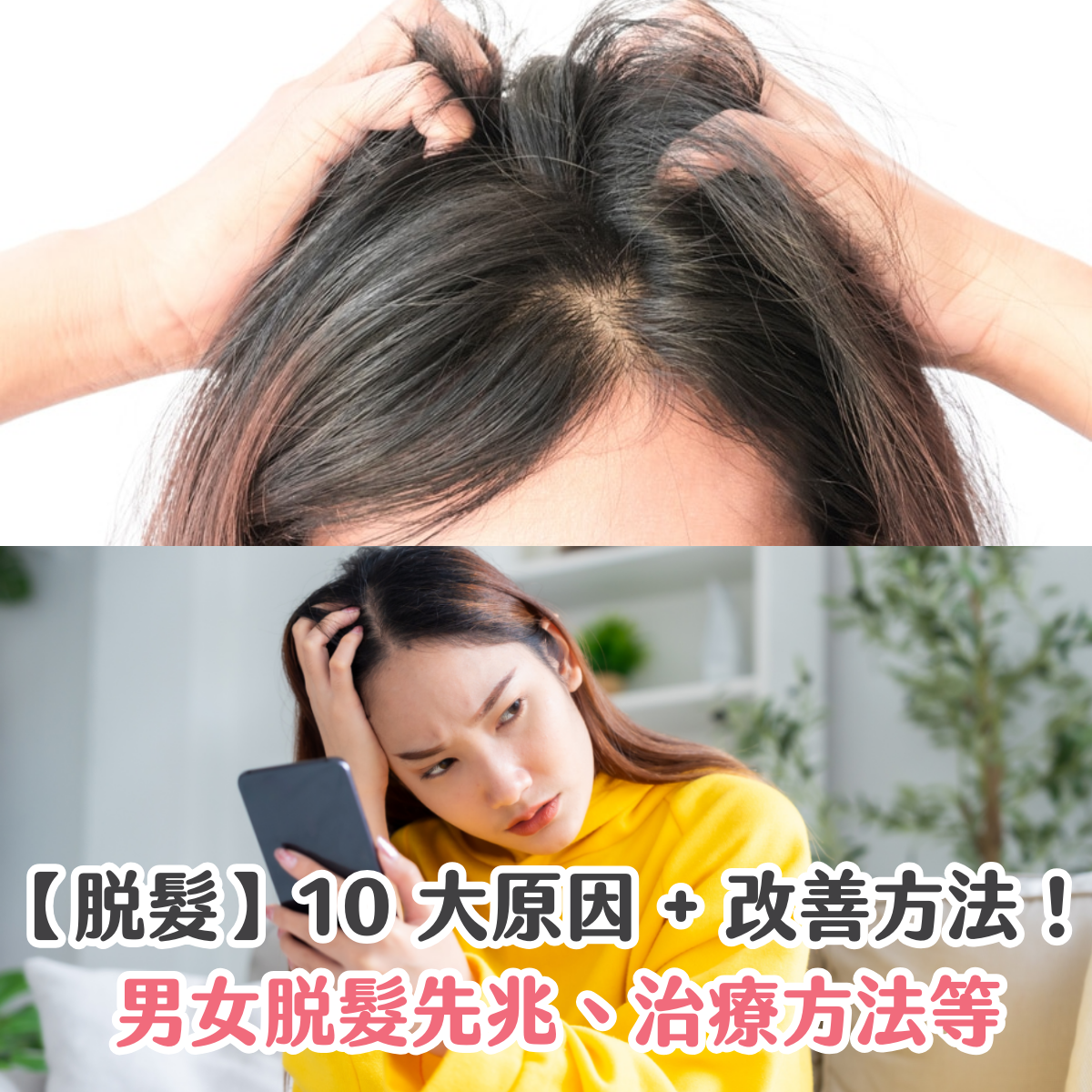 【脫髮】10 大原因 + 改善方法！男女脫髮先兆、治療方法等
