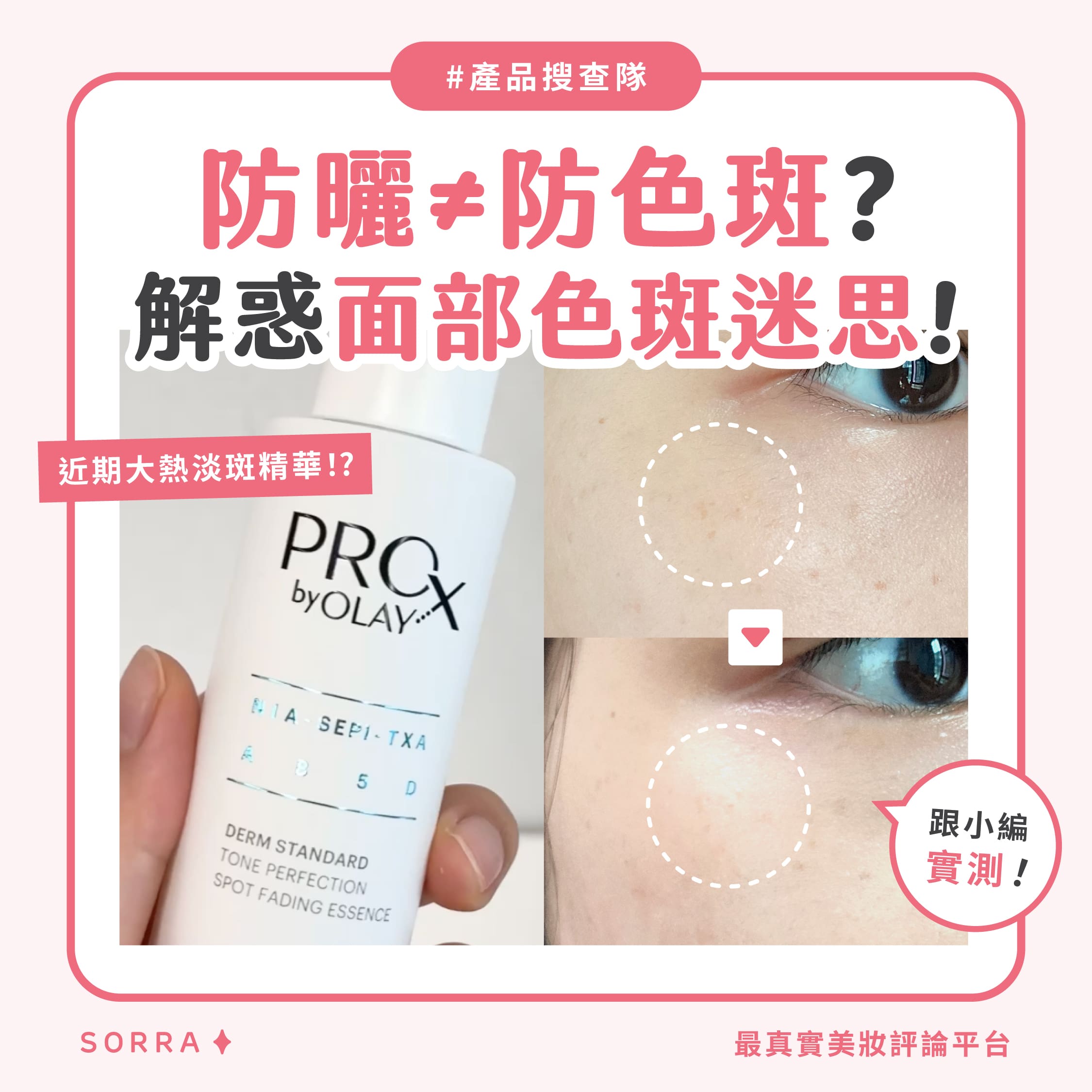 【#sorra產品搜查隊】防曬≠防色斑？解惑面部色斑迷思！
