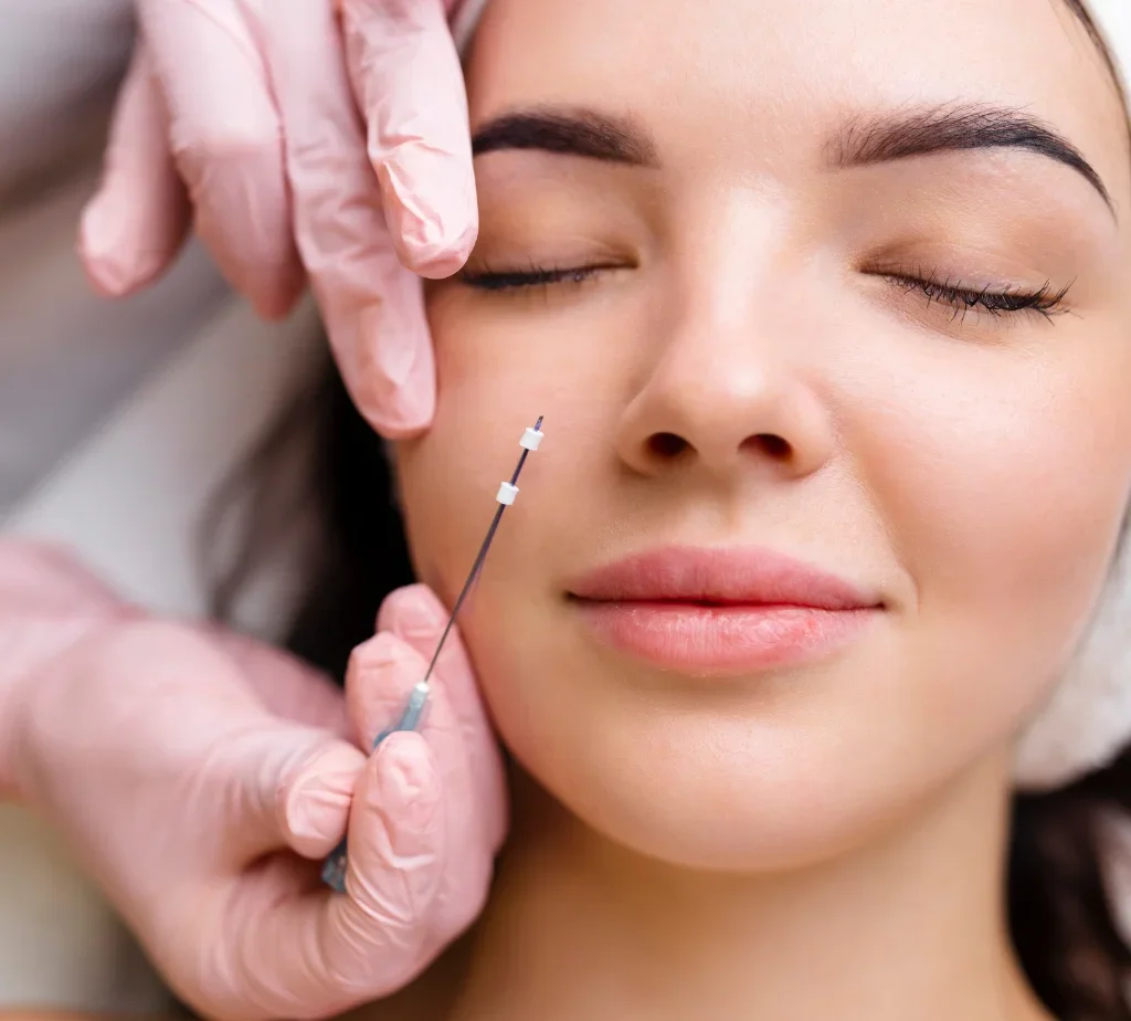 埋線拉提能維持多久