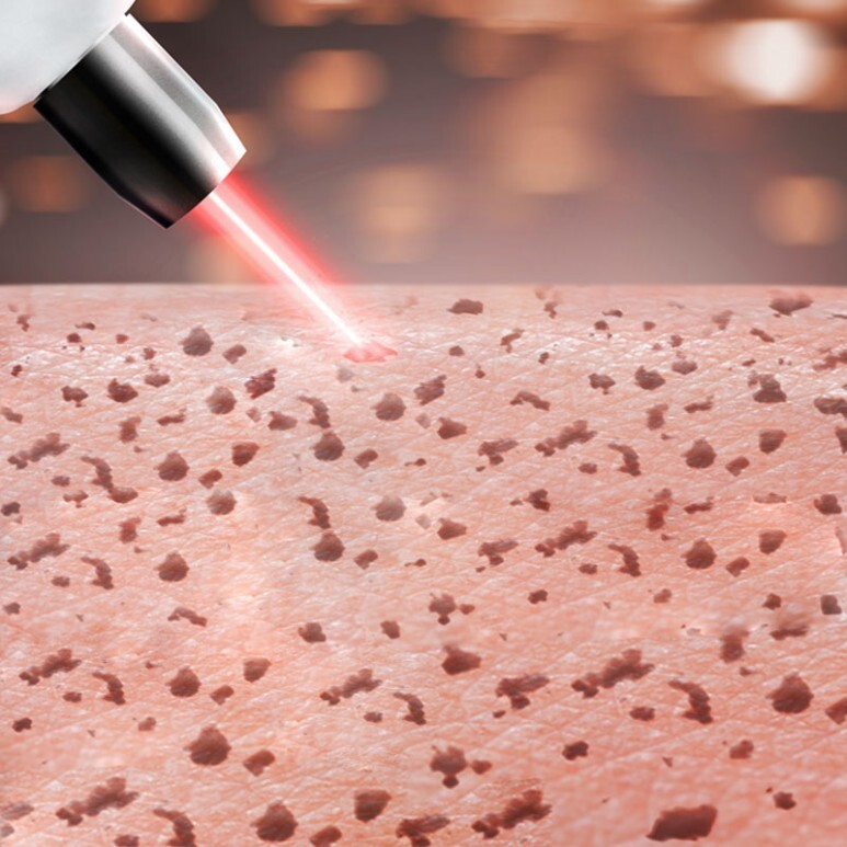 Pico 皮秒是什麼