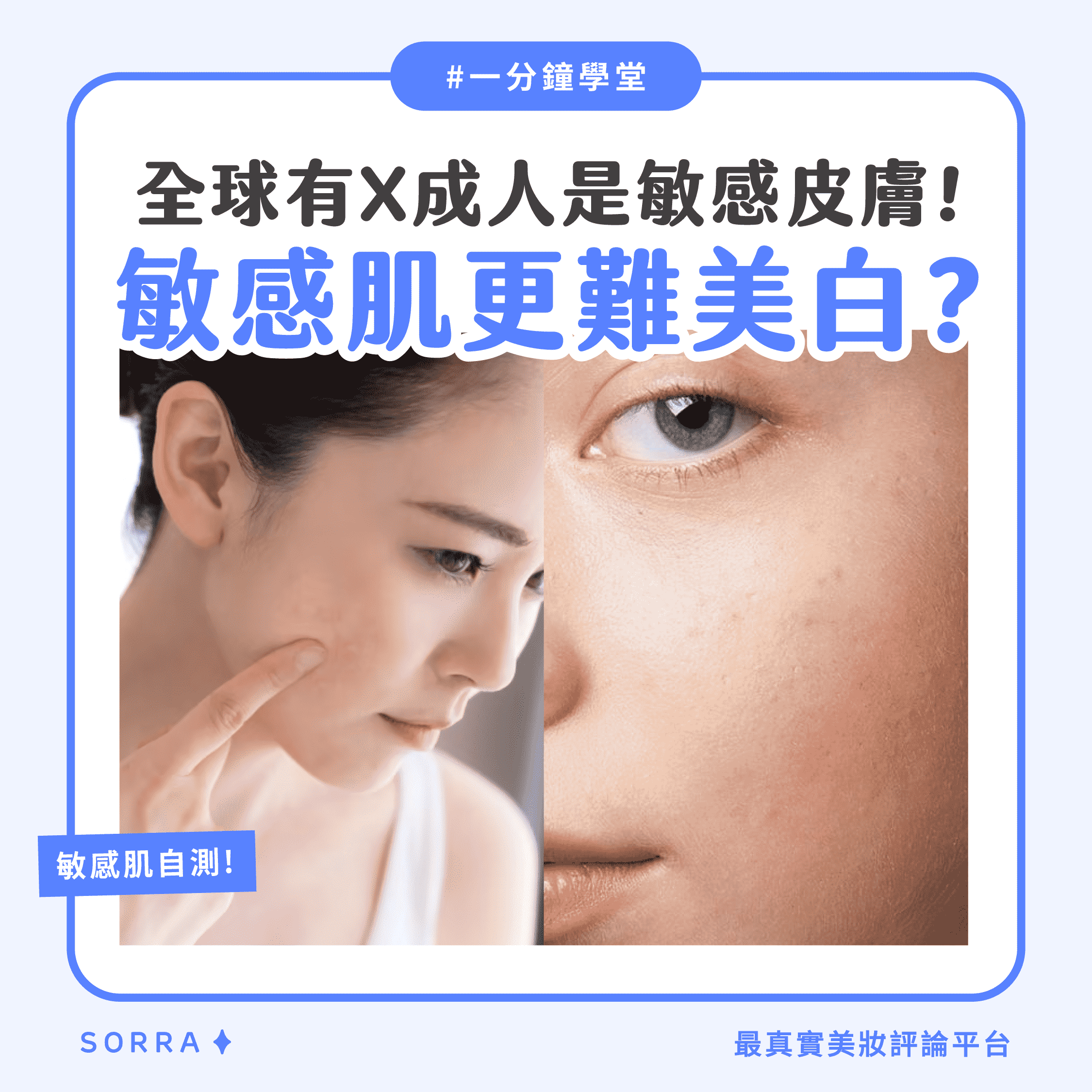 【#sorra一分鐘學堂】全球有幾成人是敏感皮膚？敏感肌更難美白？