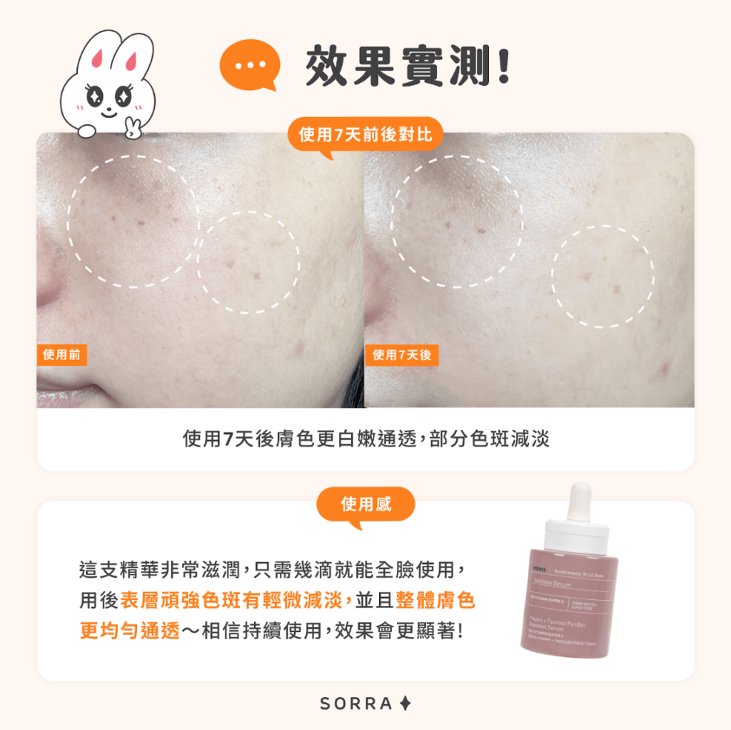 KORRES 野玫瑰15% 維他命C美白祛斑精華