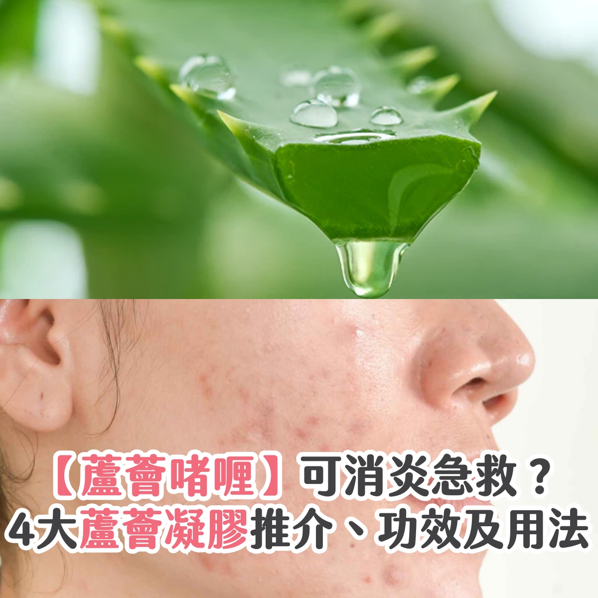 【蘆薈啫喱】可消炎急救？4大蘆薈凝膠推介、功效及用法