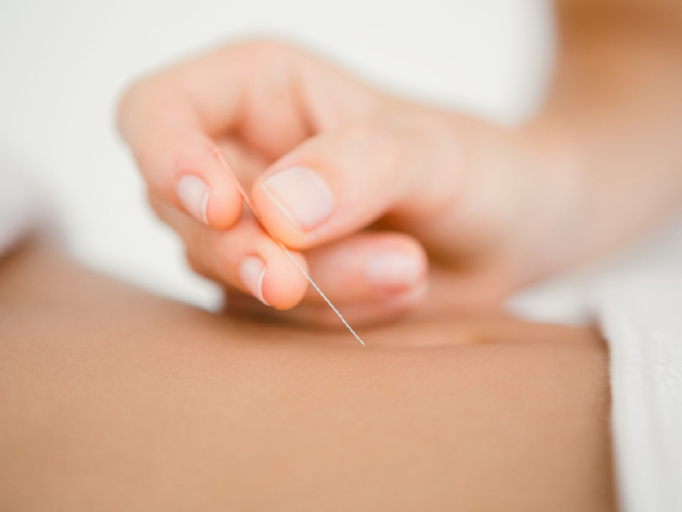 針灸改善黑眼圈