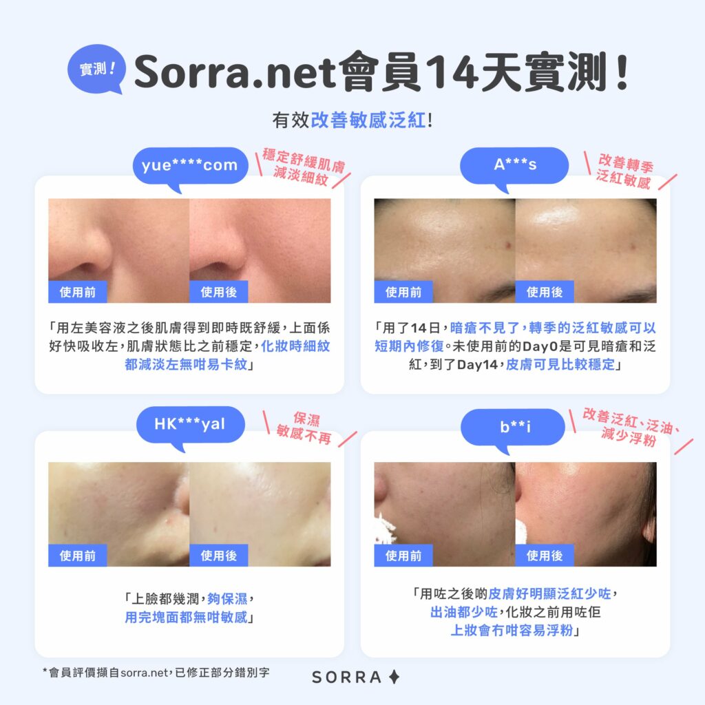 sorra.net會員14天實測!有效改善敏感泛紅!