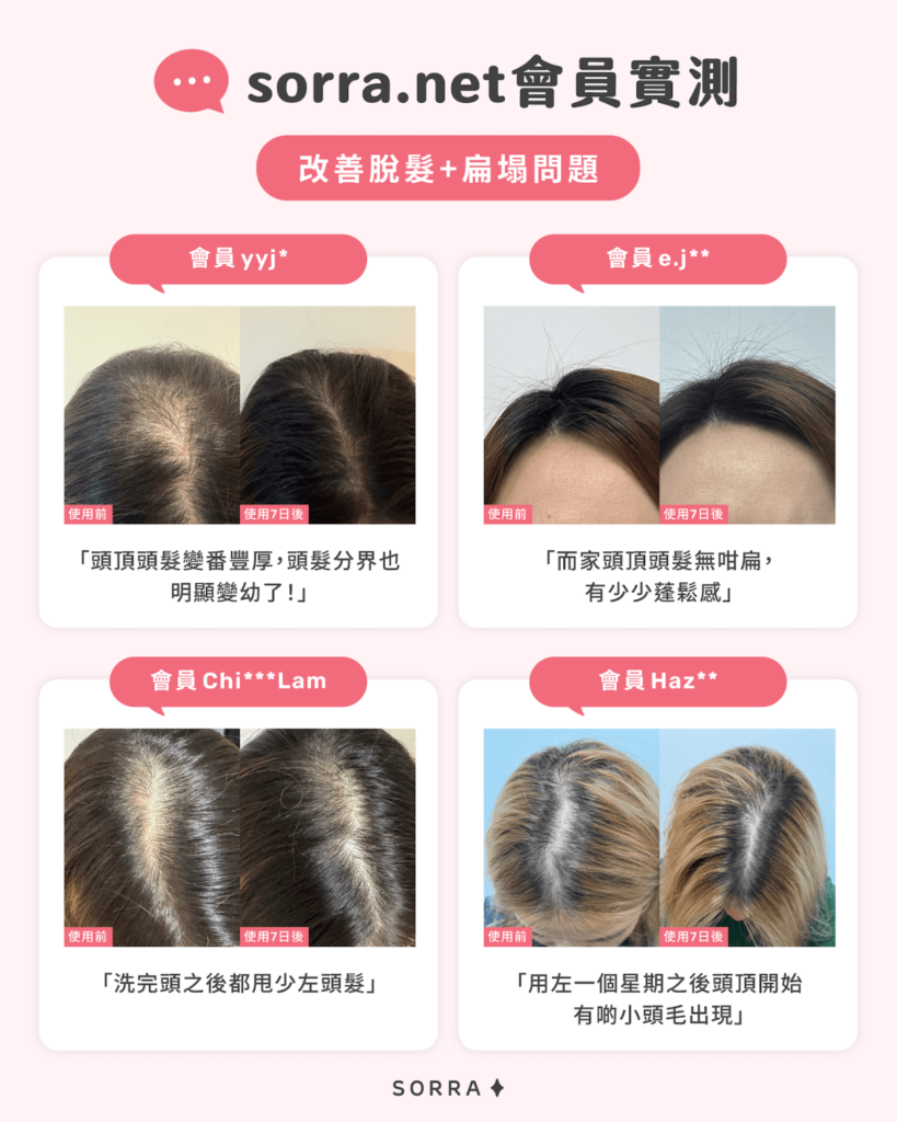 PANTENE爆髮精華 - sorra.net會員實測