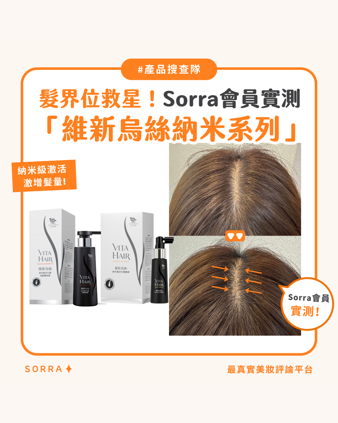  【產品搜查隊】髮際線救星！Sorra會員實測「維新烏絲納米系列」!