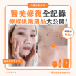 【產品搜查隊】醫美修復全記錄 療程後護膚品大公開！