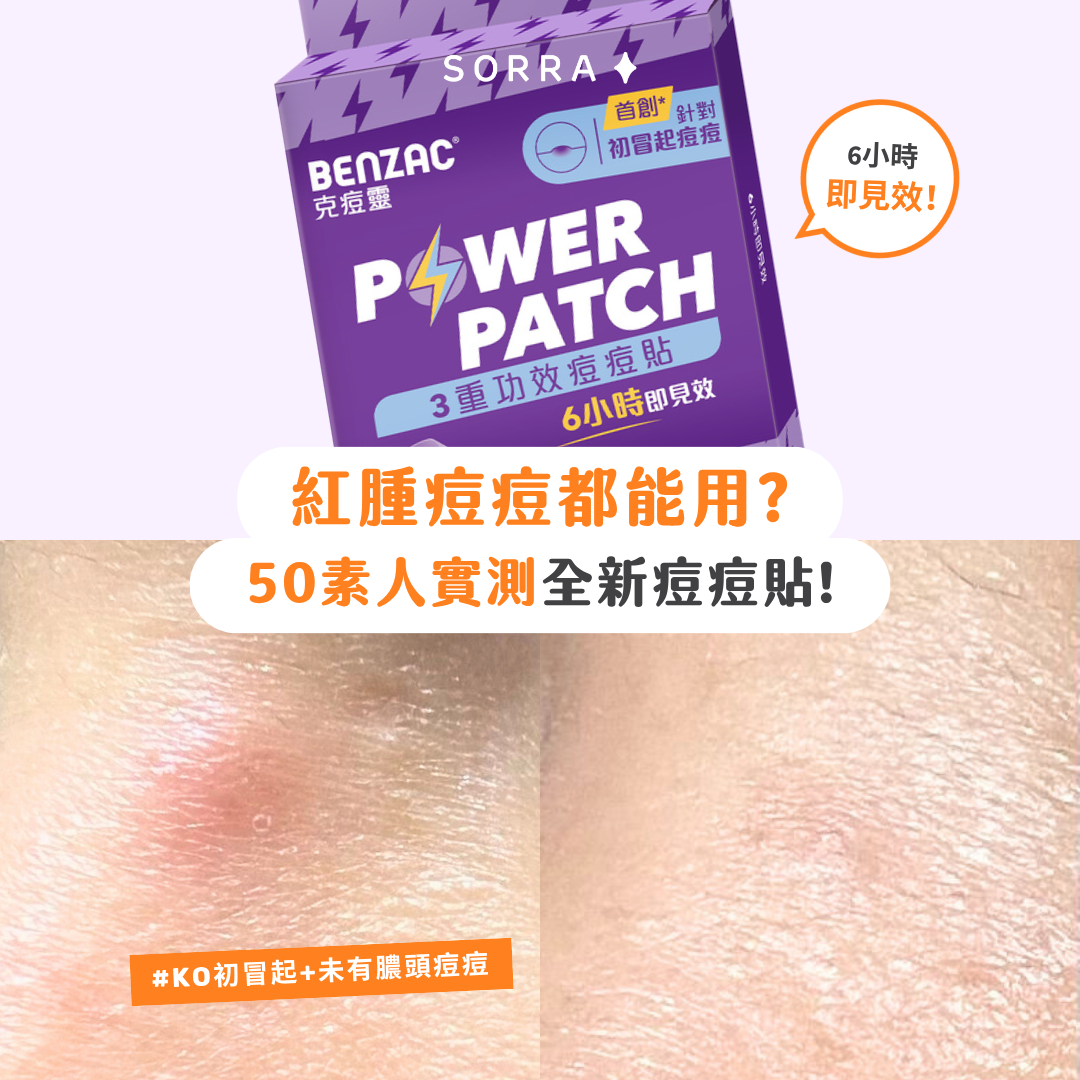 【#sorra產品搜查隊】紅腫痘痘都能用？50素人實測全新痘痘貼！