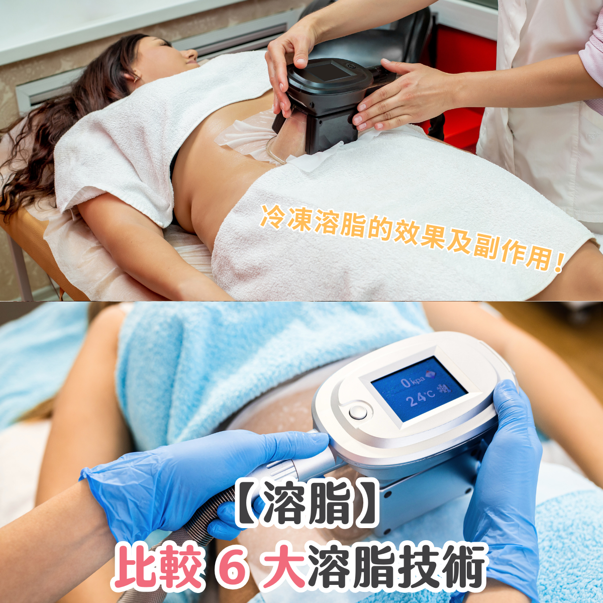 【溶脂】比較 6 大溶脂技術 + 冷凍溶脂的效果及副作用！
