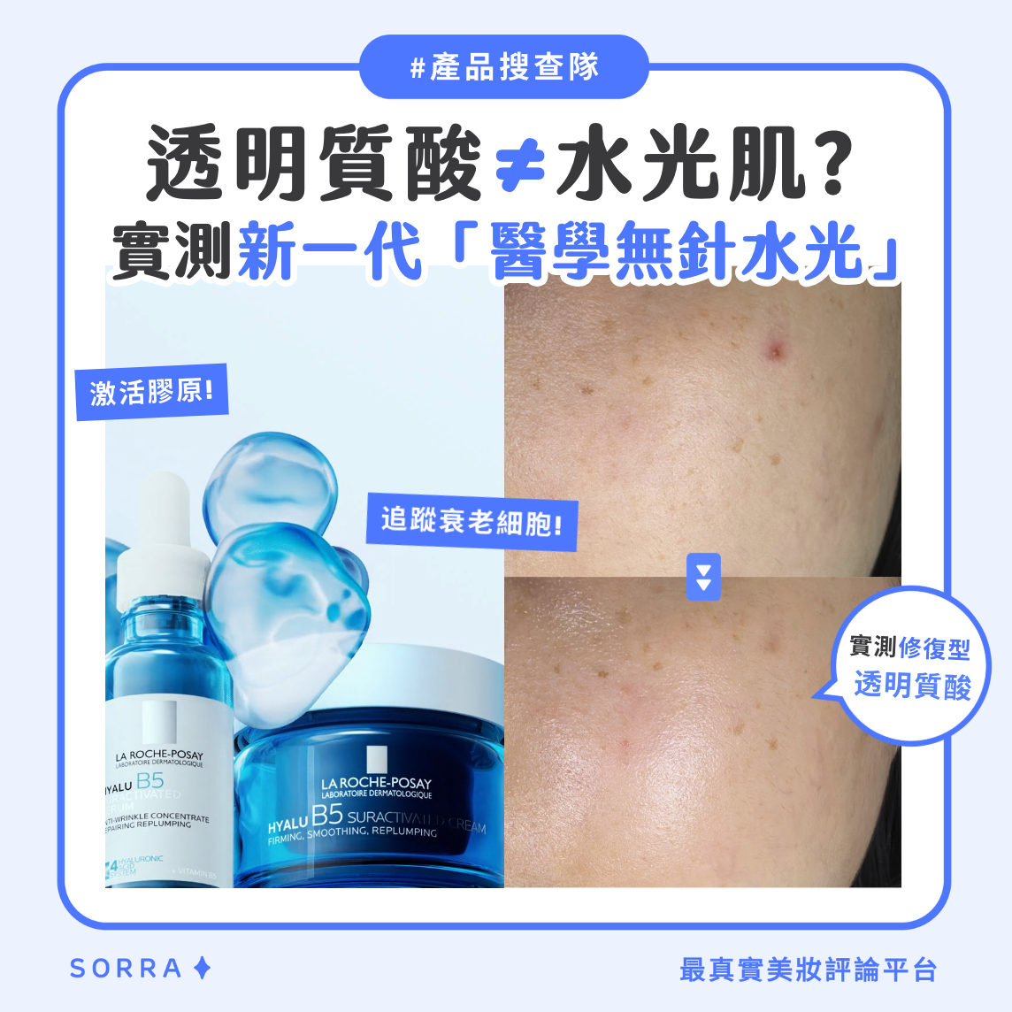 【#sorra產品搜查隊】透明質酸 ≠ 水光肌!實測新一代「醫學無針水光」