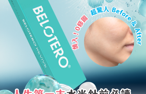 受保護的內容: 【Facial 醫美必讀】人生第一支！甘油 x 透明質酸水光針？實測大熱 Belotero Revive + 附超驚人 Before & After