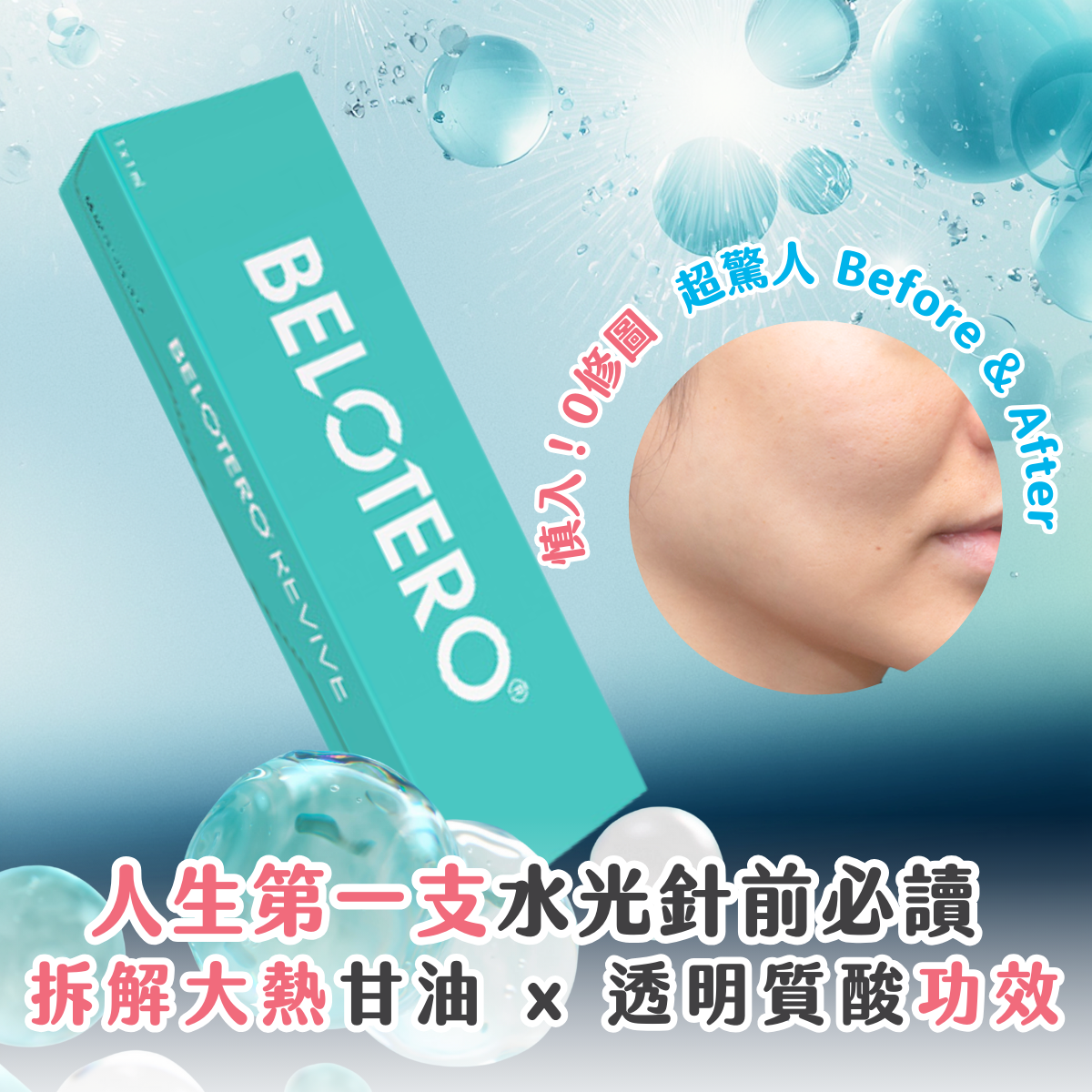 受保護的內容: 【Facial 醫美必讀】人生第一支！甘油 x 透明質酸水光針？實測大熱 Belotero Revive + 附超驚人 Before & After