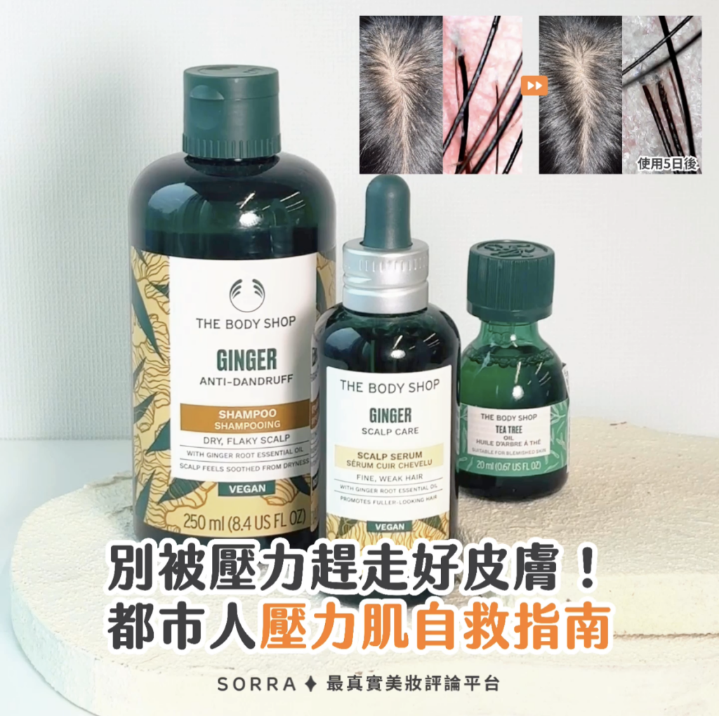 別讓壓力奪走健康頭皮!都市人「壓力肌」自救指南