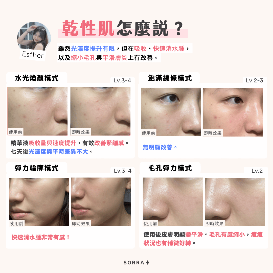Medicube AGE-R Booster Pro 的乾性肌評價